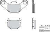 BREMBO Brake Pads 07KA07SD Sintered Metal | 07KA07SD